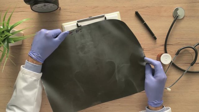 SAKROILIITIS IM MRT SICHTBAR visual data 6