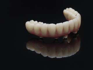 Complete lower prosthesis dental screwed over black glass.