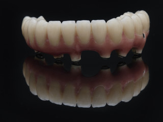Complete lower prosthesis dental screwed over black glass.