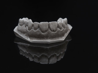 Gray plaster model dental over black glass. Jaw prothetic