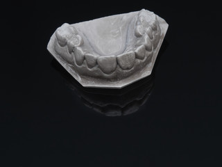 Gray plaster model dental over black glass. Jaw prothetic