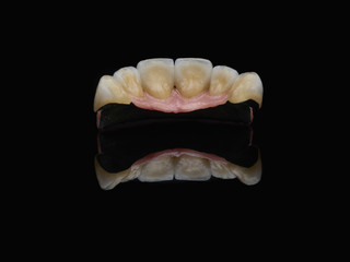 Metal ceramic bridge with pink gum. Fixed implant denture over black glass mirrow with reflexion.
