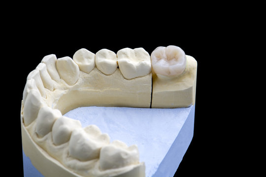 ceramic tooth