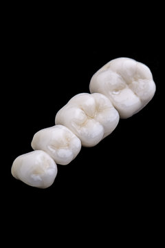 ceramic tooth