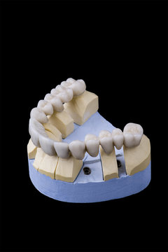 ceramic teeth on the model