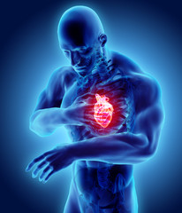 3d illustration of human heart attack. - obrazy, fototapety, plakaty