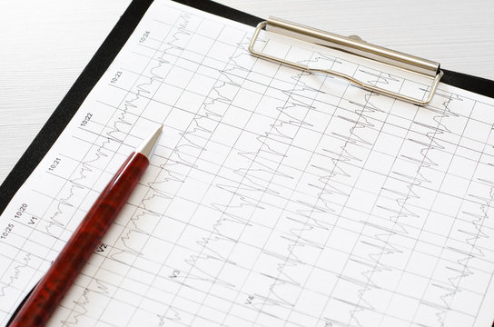 Electrocardiogram graph (ECG), heart analysis.  Black clipboard