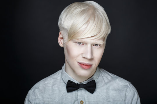 albino man white skin