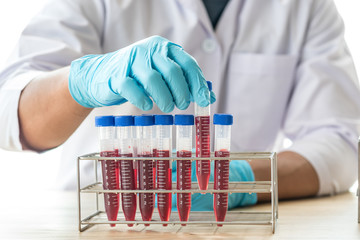 scientist or doctor hand select blood test tube in rack