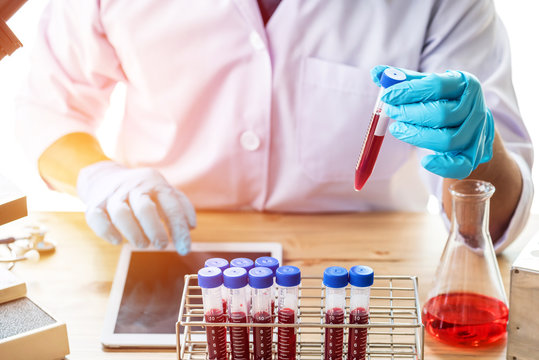 scientist or doctor holding a blood test tube in hand and searh data in tablet , research  concept