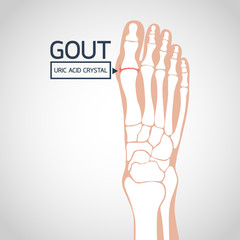 Gout vector logo icon illustration