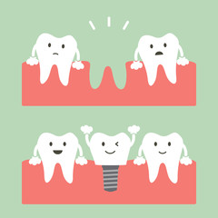 filling dental implant with crown, before and after