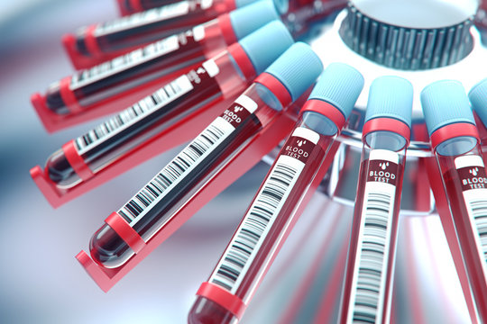 Lab equipment centrifuging blood. Concept image of a blood test.3d rendering.