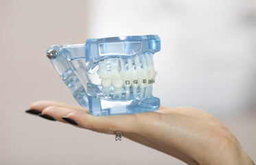 Dental and orthodontic office and lab presentation tool. Model of human jaw for dental care and orthodontics concept.