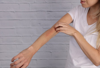 Woman Scratching an itch on white background . Sensitive Skin, Food allergy symptoms, Irritation