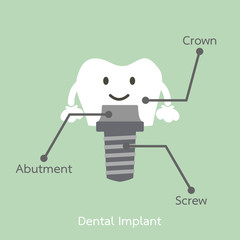 structure of the dental implant with all parts disassembled, crown, abutment, screw