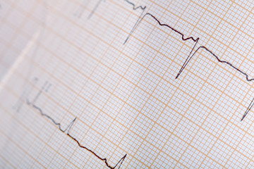 Medical background for design with ECG trace