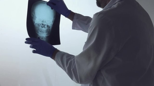 Doctor examining x-ray of the patient's skull in a medical clinic. Healthcare professional analyzing imaging test of human head.