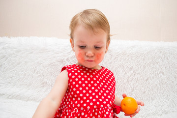 beautiful baby girl in a dress with an allergic rash on her cheeks because of eating citrus fruits,...