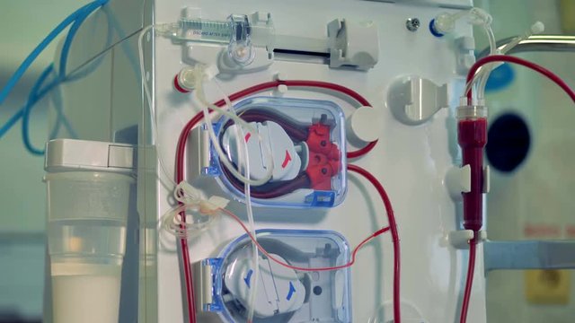 A view on a dialysis machine with a screen from bottom to top. 