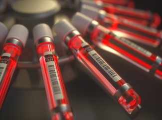 3D illustration. Centrifuge blood machine. Chemical test, bright red liquid inside the test tubes.