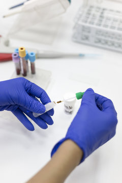 Helicobacter pylori rapid test performed in a lab