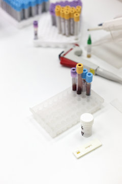 Helicobacter pylori rapid test on a lab's table showing negative result
