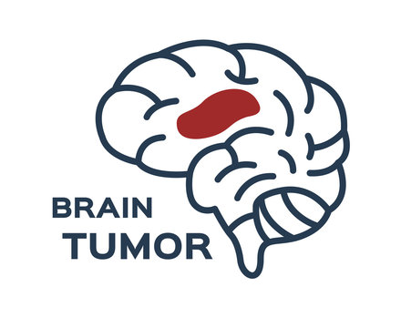 Brain Tumor Vector Icon