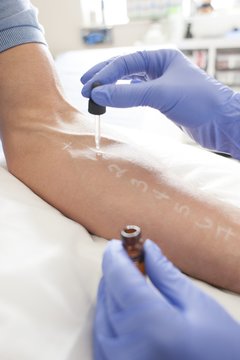 Patient undergoing a skin prick test