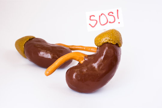 Natural anatomical 3D kidneys model with placard inscripted SOS referring to patient or doctor for help. Conceived for all symptoms, syndromes, diseases and pathologies of kidneys and adrenal gland