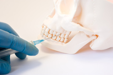 Dental anesthesia or puncture cyst tooth concept photo. Doctor dentist holding syringe, needle stabs into upper jaw of skull above the teeth, pursuing dental anesthesia procedure, cyst puncture © shidlovski