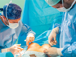 Real surgery team in the operating room. Photos from a live session of breast augmentation surgery.