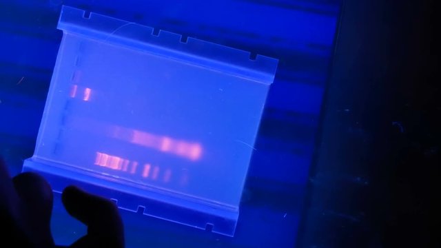 Visualization of fractionated in agarose gel DNAs stained with ethidium bromide in ultraviolet