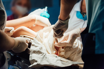 surgeon making surgery for patient with pneumonia