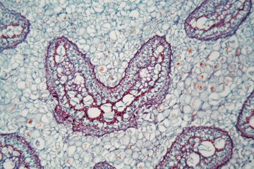 Fern stem under the microscope