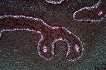  Fern stem under the microscope and in polarized light.