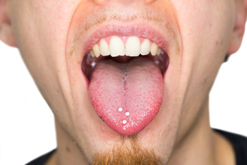 Closeup of a young, handsome male person ingesting homeopathic globules to gently treat diseases