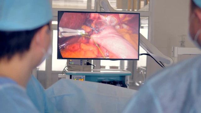 Surgeons use several trocars for medical scissors and stitching instruments. 