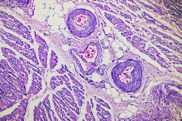 blood vessel in human skeletal muscle