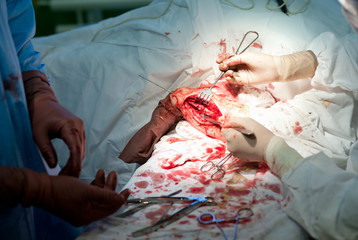 surgical operation