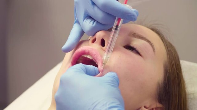 Lip injection plastic surgery. Close up face of patient during lip augmentation