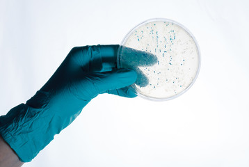colonies  in petri dish for cloning of transgenic vector into plasmid DNA