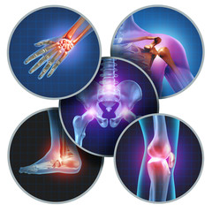Human Painful Joints - obrazy, fototapety, plakaty
