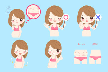 pregnant woman with stretch marks