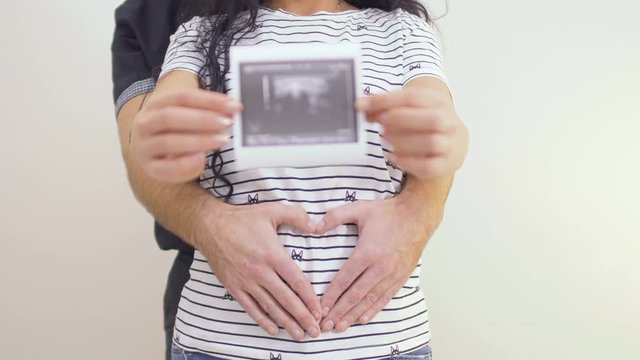 Young parents with photo of ultrasound their future baby