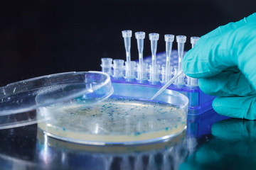 Scientist hand  picks up bacterial colonies for cloning of transgenic vector into plasmid DNA