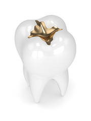 3d render of tooth with dental gold filling