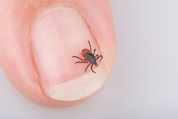 Close-up of tick on human nail. Ixodes ricinus. Dangerous parasite and carrier of infection such as encephalitis and Lyme disease.