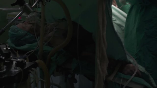 Tracking shot from tubes of oxygen machine and patient with mask lying on table under regional anesthesia to team of surgeons during using surgical tools to operating knee at operation theatre.
