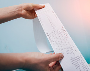 Fototapeta premium Doctor with electrocardiogram equipment making cardiogram test